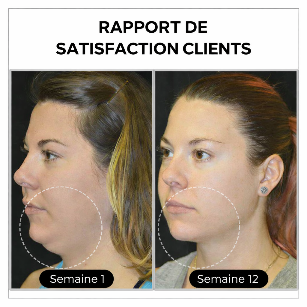 OFFRE FLASH -80% 💎 Czticle® Histone Magnetology Lymphvity Boucles d'Oreilles en Germanium