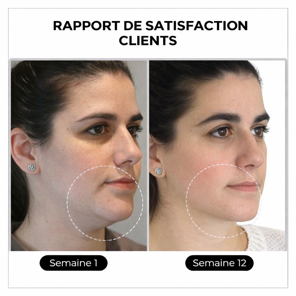 OFFRE FLASH -80% 💎 Czticle® Histone Magnetology Lymphvity Boucles d'Oreilles en Germanium